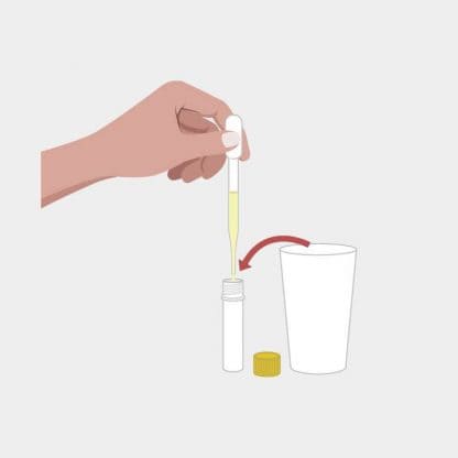 Test kit urine
